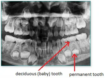 Dental X-Ray of permanent and baby teeth